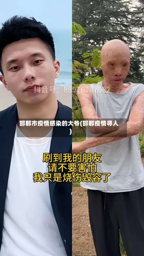 邯郸市疫情感染的大爷(邯郸疫情寻人)-第2张图片